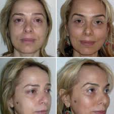 International Textbook of Aesthetic Surgery