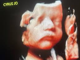 Fundraiser by Dakota Stinnett : Support Dakota, Kate, and Baby Cyrus's  Medical Journey