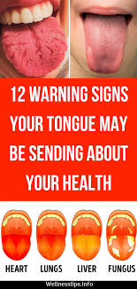 Read On To Discover Some Of The Warning Signs Your Tongue May Be Sending And Learn What To Look For In Order To Id Healthy Tongue Health And Beauty Tips Health