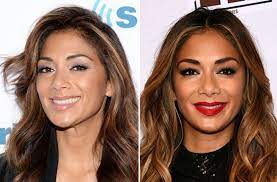 Check out full gallery with 4499 pictures of nicole scherzinger. Hat Nicole Scherzinger Zu Viel Botox Im Gesicht Botox Co Stars Im Schonheitsfieber Cosmopolitan