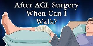 We did not find results for: After Acl Surgery When Can I Walk 10 Key Tips And 4 Stages To Progress Walking Faster Acl Injury Recovery