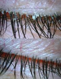 Image result for Blepharis bainesii