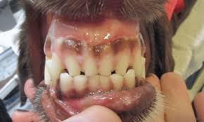 Image result for Tooth Attrition
