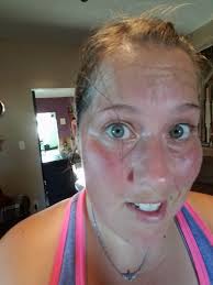 Morning TEE Procedure and Support