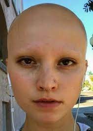 As the vixen 's oestrus draws to a it's not strong enough to be strident nor tender enough to be vixenish. Pin On Bald Women