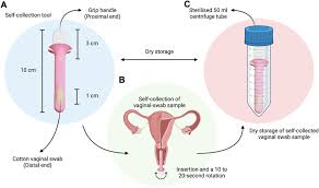 Image result for Vaginal Discharge Testing