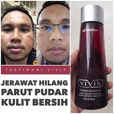 Testimoni Kecantikan Kulit Muka Dengan Vivix 1 Vitamin Water Bottle Shaklee Drink Bottles