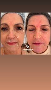 E você? Também sente que seu rosto está desabando?, Marque sua avaliação e  faremos todo o seu protocolo de tratamento, para um gerenciamento natural e  saudável das necessidades da sua pele , ...