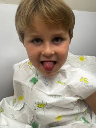 refusing concerta for adhd child with motor tics