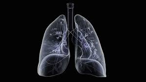 8 Signs Your Cough Could Actually Be Pneumonia Pneumonia Symptoms Pneumonia Bronchitis Symptoms