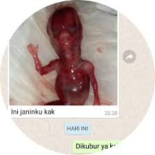 Selain dapat melancarkan keluarnya darah haid, cara ini juga akan membantu mengatasi rasa kram atau nyeri haid. Cara Melancarkan Haid Yang Paling Ampuh