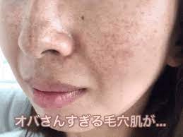 肌の老化原因を毎日除去 黒垢 いっきにそぎ落とす 赤の生バーム 43歳おば肌の変貌ぶりにsns炎上 pr mellife 何歳になっても解決しないエンドレスな毛穴悩みにウンザリしてませんか 服や髪を小奇麗にしてた 顔 毛穴 毛穴 色素沈着