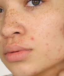 как сделать лицо чистым и гладким в домашних условиях Skincare That Skips The Nasties Direct From Downunder 100 Cruelty Free Award Winning Products Free Delive V 2020 G Chistoe Lico Kosmeticheskie Tovary Makiyazh Nyx