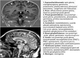 A small number of childhood cancers can be related to down syndrome (trisomy 21), or other inherited genetic abnormalities called mutations. Childhood Brain Tumors American Academy Of Pediatrics