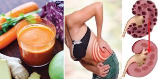 Carrot Cabbage Kidney Cleanse Juice Reduce Bloating And Prevent Kidney Stones Kidney Detox Cleanse Kidney Cleanse Natural Kidney Cleanse