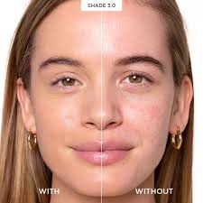 Foundation & Bases overview