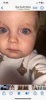 Family eye color inheritance patterns