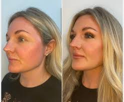 Hi! I'm Gina, a Licensed Esthetician and MUA who specializes in wedding and  special event makeup. I am the owner of Valerian Glow Esthetics. I  genuinely love glamming clients and helping them