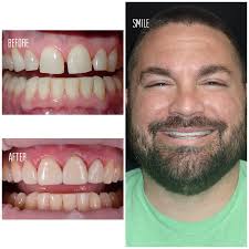 Boulevard benito juárez 69, rosarito centro, rosarito, rosarito, baja california 22710. Perfect Smile Dental In Tijuana Mexico Read 39 Reviews