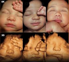Medical imaging has entered a breathtaking new era — AI-enhanced 8K  ultrasounds that turn standard 3D baby scans into lifelike portraits. By  combining high-resolution imaging with artificial intelligence, these  systems can now