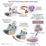 Image result for how to rid car-t after treatment