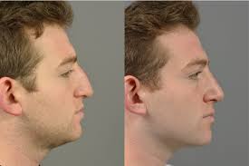 Plastic Surgery Long Island, NY