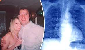Lung Cancer Woman Who Never Smoked Died After Stress Diagnosis Express Co Uk