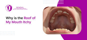 Image result for Physical injury red spots roof of mouth