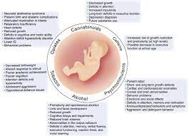 Developmental Consequences Of Fetal Exposure To Drugs What We Know And What We Still Must Learn Neuropsychopharmacology