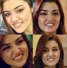 Hayranları sosyal medyayı aktif olarak kullanan burcu özberk'in özel hayatını merak ederken burcu özberk'in estetiksiz hali görenleri şok etti. Burcu Ozberk Estetiksiz Hali Ile Sasirtti