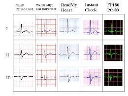 1 Lead To 12 Lead And Exercise Ecg