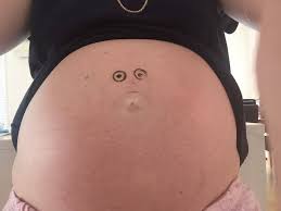 4 Weeks Pregnant Belly Button Novocom Top