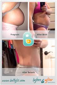 I Purchased The Bellefit Corset 2 Weeks After My C Section On October 27 2014 I Wear The Bellefit Corset In 2020 Bellefit Bellefit Postpartum Girdle Postpartum Belly