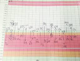 observation chart showing fluctuations in blood pressure