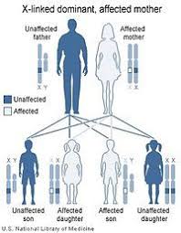 Pin On Peculiar Findings Diseases Such
