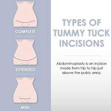 Rubinstein developed a financing program for his patients. Tummy Tuck Miami 3800 Abdominoplasty Avana Plastic Surgery