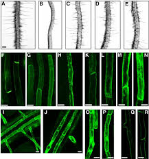 As a teen, i felt helpless and hopeless as i lost more than a third of my hair to autoimmune disease and my prescribed medications. Effects Of Npa Bfa And St On Root Hair Growth Of Pidox Roots And The Download Scientific Diagram