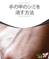 加齢のサイン 手の甲のシミを目立たなくする方法 スキンケアのアドバイス 美容 手作りスキンケア