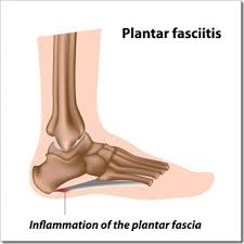 How much does a medical biller make at the foot care center in billings, mt? Plantar Fasciitis Billings Mt Chiropractor Billings Mt Van Chiropractic Clinic