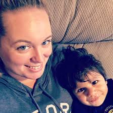 Orphan covered in hair from malnutrition after being starved for seven  years