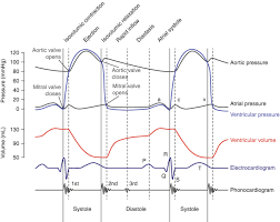 Image result for Preload