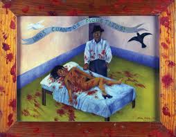 Frida kahlo has poor health in her childhood. Nachtlicher Besuch Bei Frida Kahlo Y Su Mundo