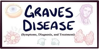 The effect on glutathione effects of selenium on short term control of hyperthyroidism due to graves' disease treated with. Graves Disease Symptoms Diagnosis And Treatment Assignment Point