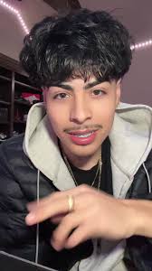 Getting my braces removed in a month 🥲 #fyp #viral