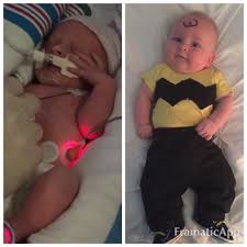 It's still a little too early to deliver baby at 32 weeks. Photos Of Premature Babies Then And Now Show Their Incredible Journey Huffpost Life