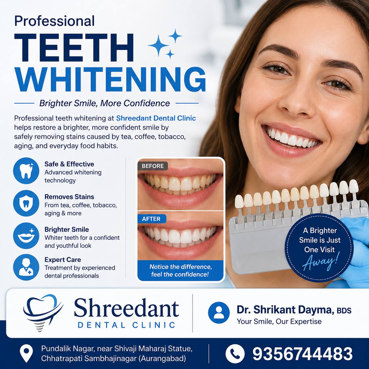 Professional teeth whitening at Shreedant Dental Clinic product image