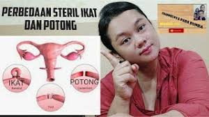 Saya tidak mahu mempunyai anak lagi kerana terlalu trauma dengan proses bersalin yang hampir meragut nyawa saya dan bayi, cerita ibu kepada tiga saya rasa lebih baik jika keputusan itu dibuat secara bersama oleh lelaki dan wanita, saya tidak rasa awak patut buat keputusan itu seorang diri. Kesan Selepas Btl Ikat Rahim Cute766