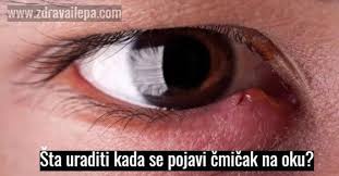 Tipične modrice koje nemaju ozbiljnije simptome mogu se sanirati kod masnica na oku i podlijev ispod oka mogu biti popraćeni nizom simptoma koji mogu zahtijevati hitnu. Sluga Njihov Povratak Vitamin K Ispod Oka Arthemis Asso Com