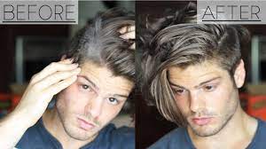 How To Get Rid Of Dandruff 3 Home Remedies Men S Hair Tutorials Miten Eroon Hilseesta Ilman Hil Getting Rid Of Dandruff Mens Hair Tutorial Mens Hairstyles
