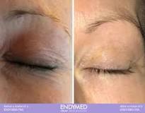 Image result